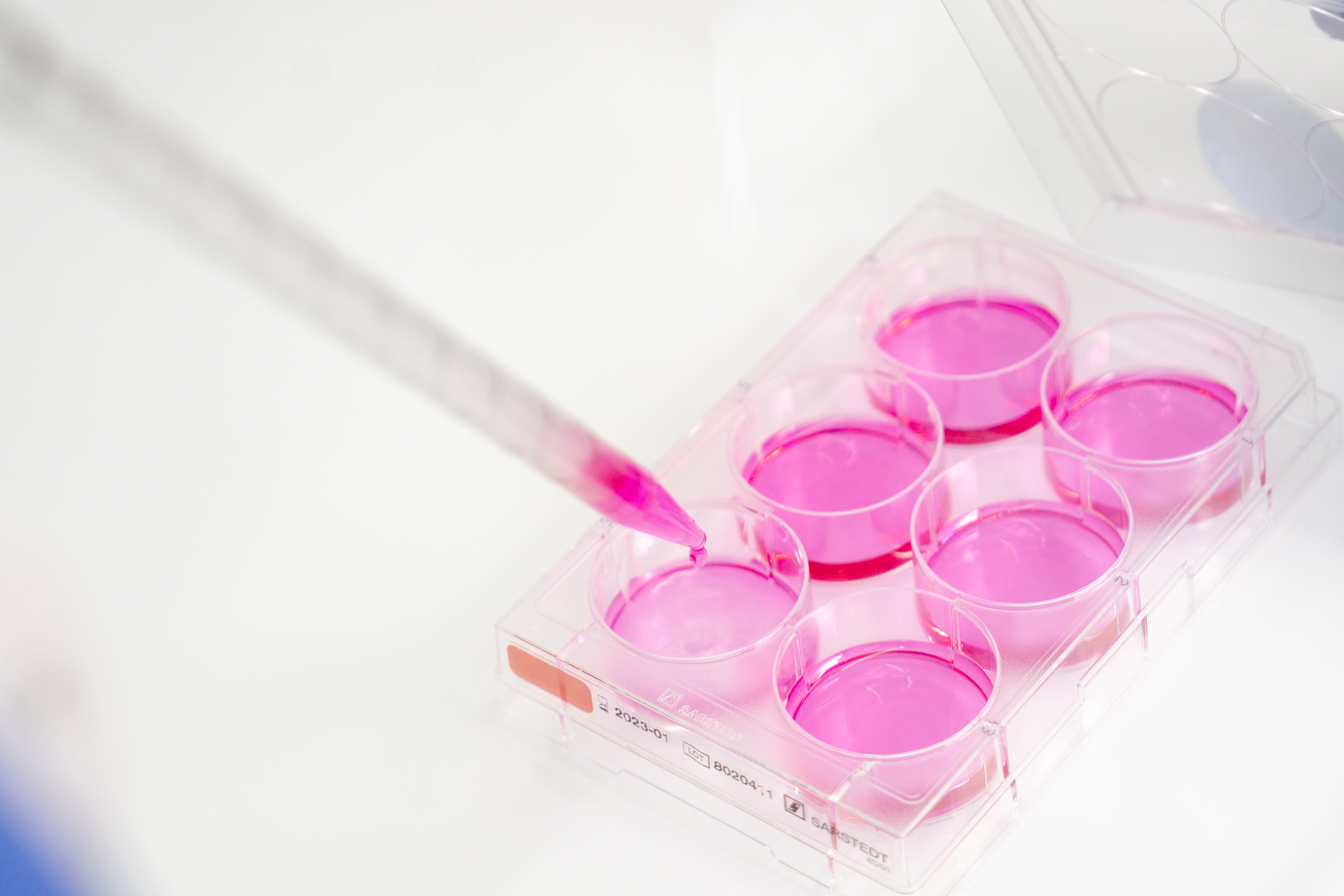 Teràpies avançades: Quan la ciència esdevé tractament